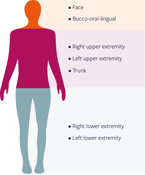 The Total Maximal Chorea (TMC) score